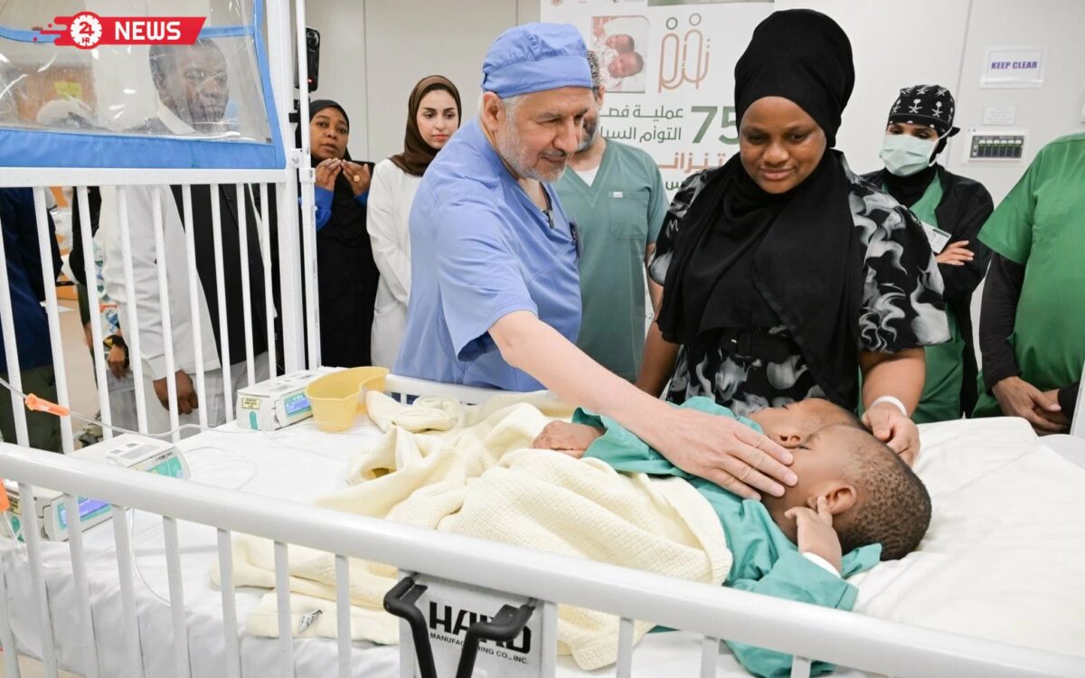 الرياض: انطلاق عملية فصل التوأم الملتصق التنزاني “لايتيينس ولوفنس”