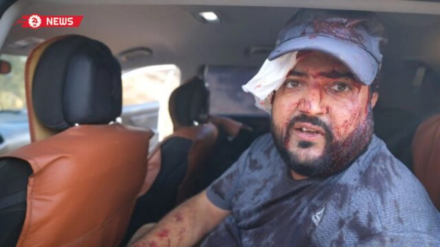 إصابة 12 فلسطينياً وصحفية أمريكية في اعتداءات لمستوطنين بالضفة