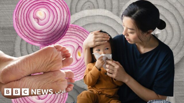 خرافة أم حقيقة: هل يساعد وضع البصل النيّئ أسفل القدمين في علاج نزلات البرد؟